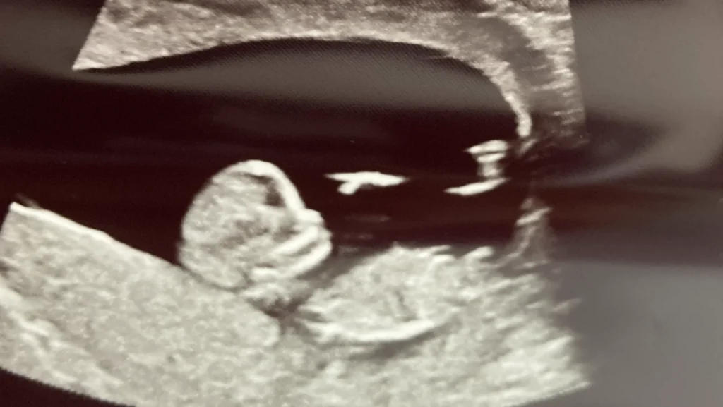 Florida launches maternal health initiative From the Start in Jax
