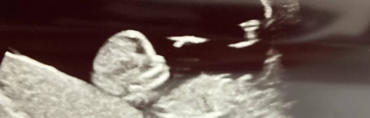 Sonogram