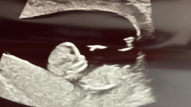 Featured image for “Florida launches maternal health initiative From the Start in Jax”