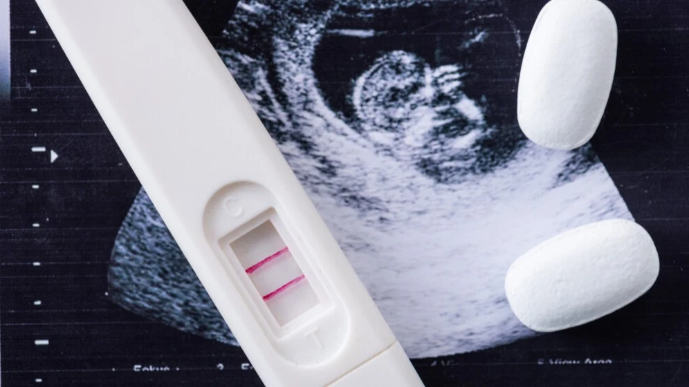 A sonogram and a home health pregnancy test.